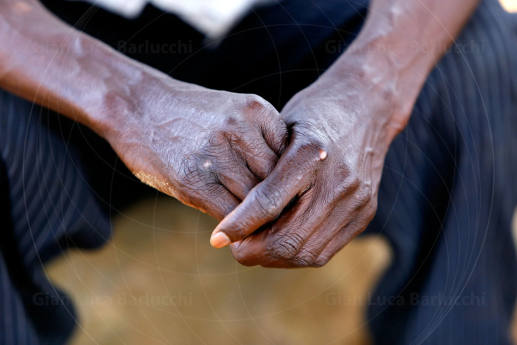 Close-up of weathered hands resting together on a person's lap